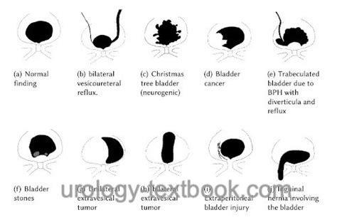 Vcug Medical Abbreviation