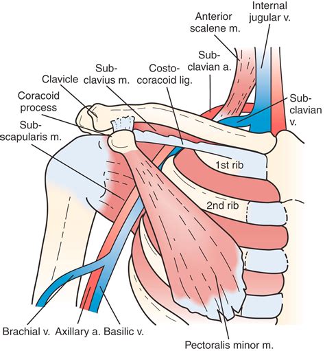 Venous Thoracic Outlet Syndrome