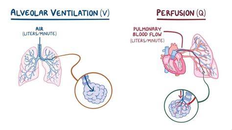 Ventilation Vs Perfusion