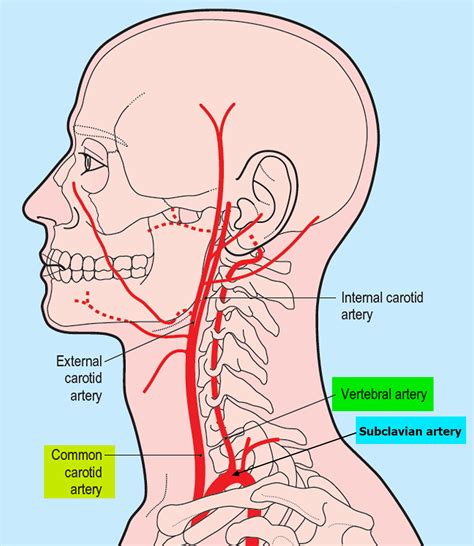 Vertebral Artery Occlusion