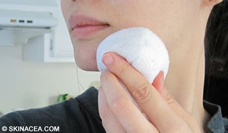Warm Compress For Cystic Pimple