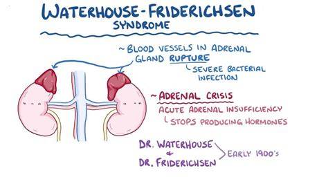Waterhouse Friderichsen Syndrome