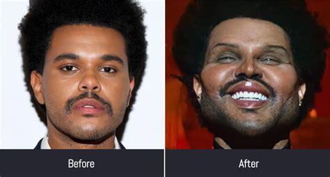 Weekend Face Surgery
