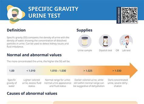 What Affects Urine Specific Gravity