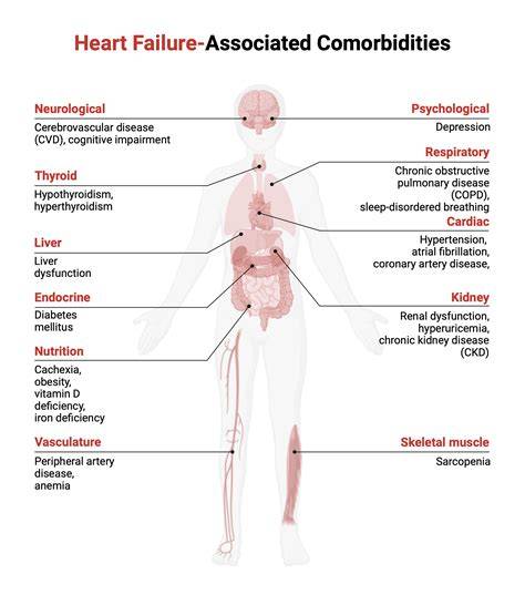 What Are Comorbidities