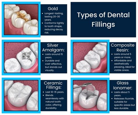 What Are Fillings Made Of