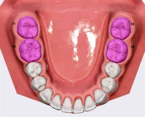 What Are Molars