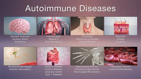 What Autoimmune Affects Joints