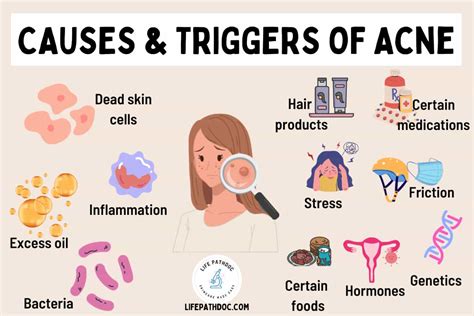 What Causes Acne