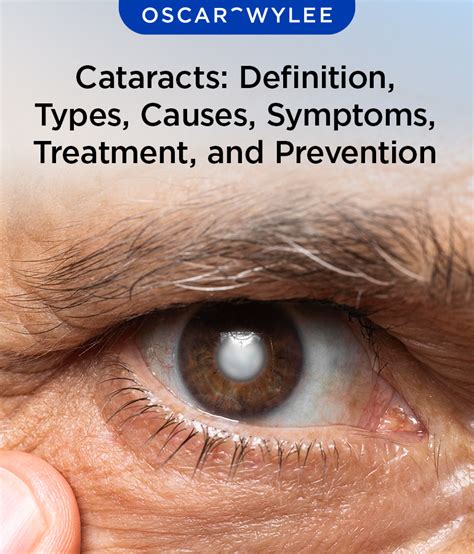 What Causes Cataract Eye Disease