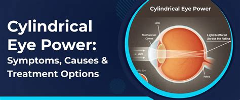 What Causes Cylinder Eye