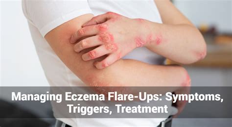 What Causes Eczema To Flare Up