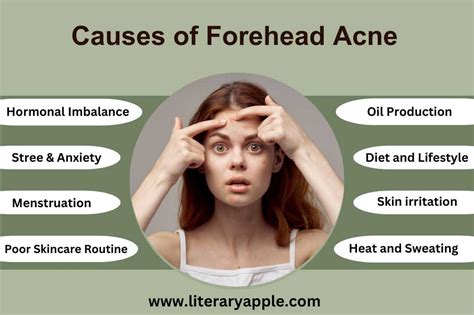 What Causes Forehead Acne