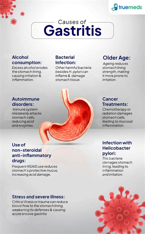 What Causes Gastritis