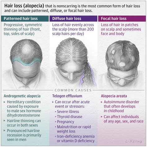 What Causes Hair Loss