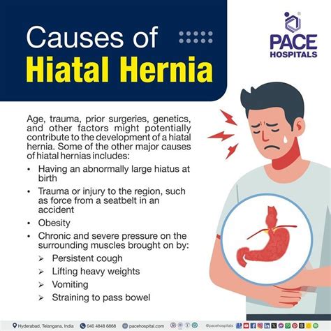 What Causes Hiatal Hernia