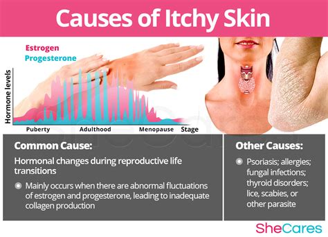What Causes Itchy Skin