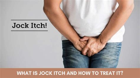 What Causes Jock Itch In Men