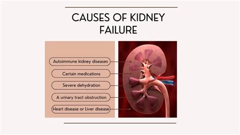 What Causes Kidney Failure