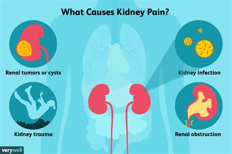 What Causes Kidney Pain
