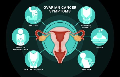 What Causes Ovarian Cancer