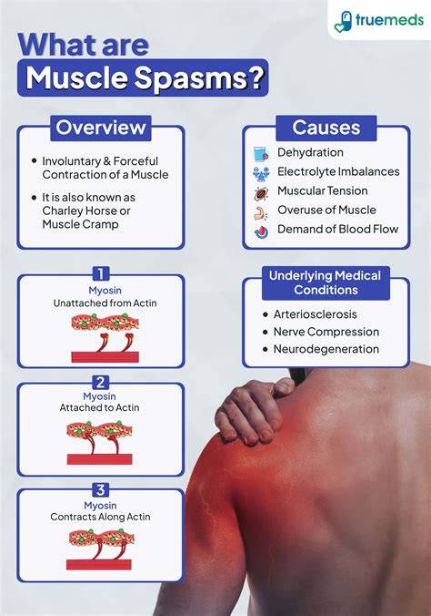 What Causes Quad Spasms