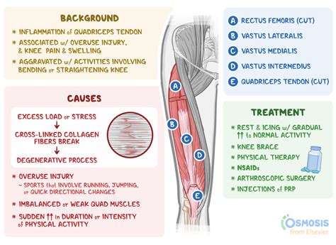What Causes Quadriceps Tendonitis