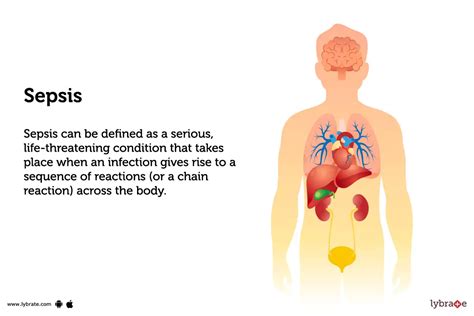What Causes Sepsis