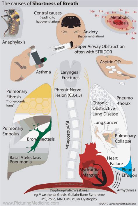 What Causes Shortness Of Breath