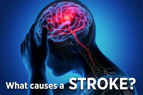 What Causes Stroke