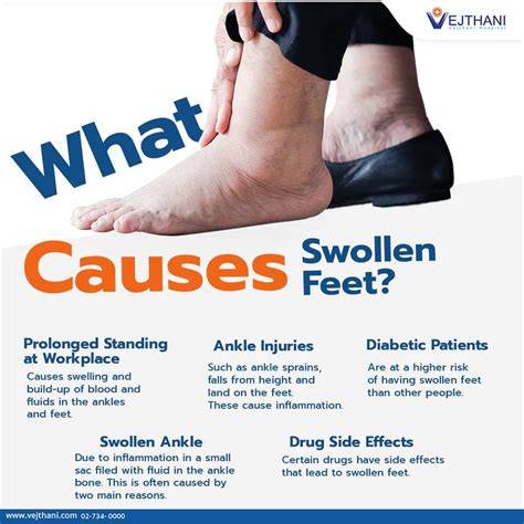 What Causes Swollen Feet