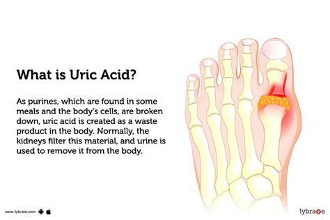 What Causes Uric Acid