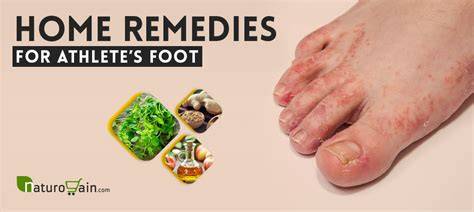 What Cures Athlete's Foot