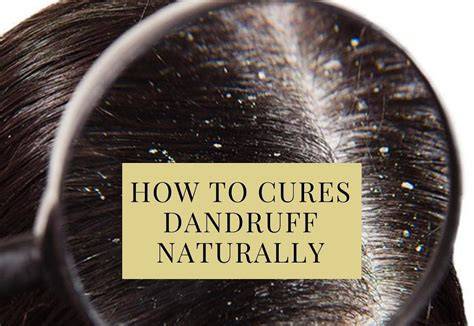 What Cures Dandruff