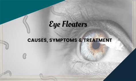 What Cures Floaters In The Eyes