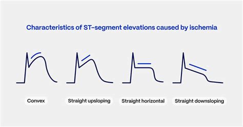 What Does 7 St And N For