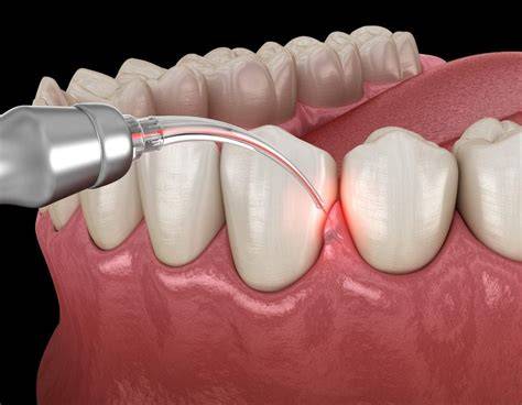 What Does A Periodontist Do