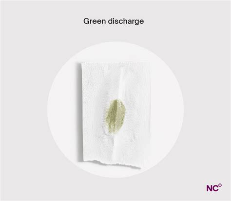What Does Green Discharge Mean