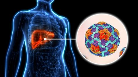What Does Hepatitis Look Like