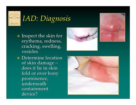 What Does Iad Looks Like