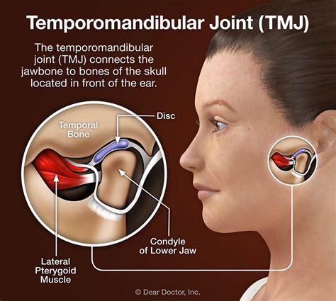 What Does Tmj Stand For