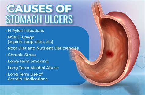 What Does Ulcer Feel Like In Stomach