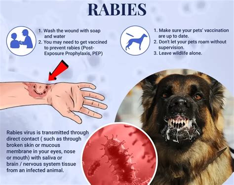 What Happens If A Human Gets Rabies