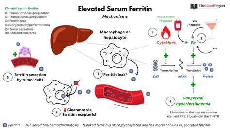 What Happens If Ferritin Is High