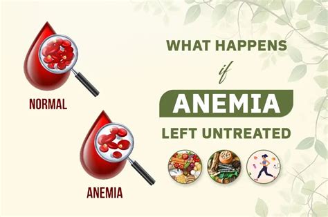 What Happens If I Leave Anemia Untreated