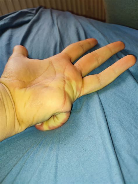 What Happens If You Are Hand Some