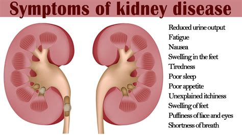 What Happens When Kidneys Fail