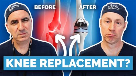 What Happens When Knee Replacement Wears Out