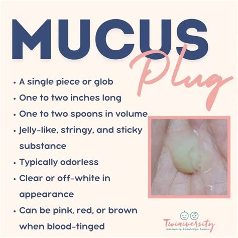 What Happens When Mucus Plug Comes Out