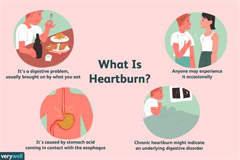 What Helps Heartburn Fast